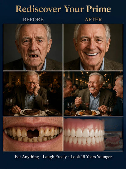 Complete‑Fit Cosmetic Smile Veneer Kit