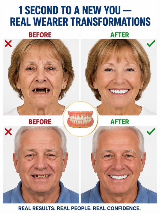 Comfort‑Fit Cosmetic Denture Set