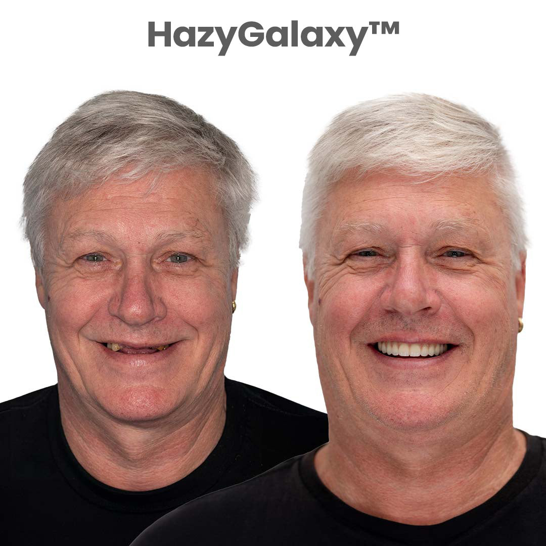 🦷 HazyGalaxy™ Custom-Fit Dentures ⏰ ENDS TODAY   88% OFF | Smile with Confidence