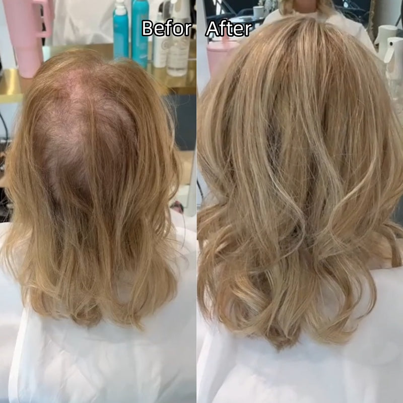 ⚡ Final Hours –🌷2026 New Lightweight & Breathable Wavy Hair Topper